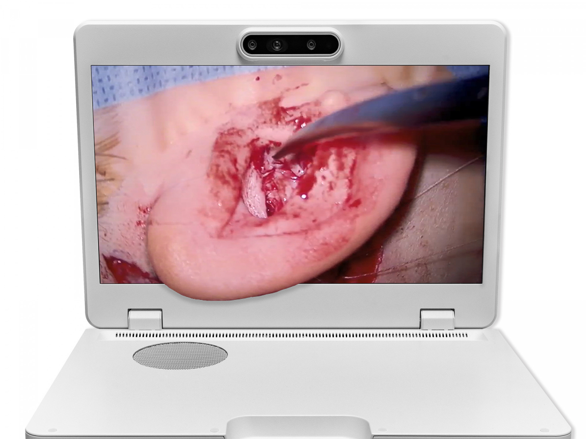 达擎之＂Heads-up 3D显微手术显示系统＂，整合4K裸眼3D显示及眼球追踪系统，具备快速追踪人眼移动位置功能，减轻医师长时间维持固定姿势的负担，让医师能有更宽广清晰的3D立体视野及更舒适的姿势来执行手术。